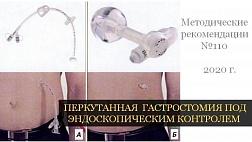 ПЕРКУТАННАЯ ГАСТРОСТОМИЯ ПОД ЭНДОСКОПИЧЕСКИМ КОНТРОЛЕМ 2020г. Методические рекомендации № 110